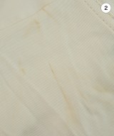 Acne Studios（アクネストゥディオズ）トレンチコート 黄 サイズ:32(XXS位) レディース/2200626936198